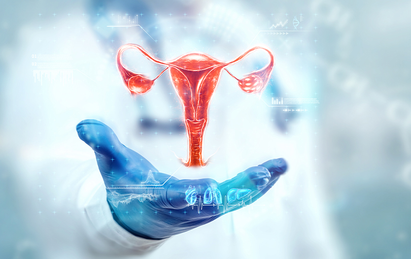 O que é a endometriose e por que ela inspira cuidados